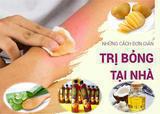 TOP 7 Cách chữa bỏng bằng những nguyên liệu đơn giản tại nhà