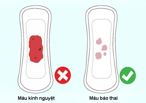 Sự khác nhau giữa máu kinh nguyệt và máu báo thai